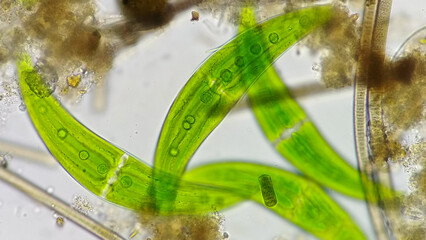 Closterium and their substrate. Live cell. Selective focus