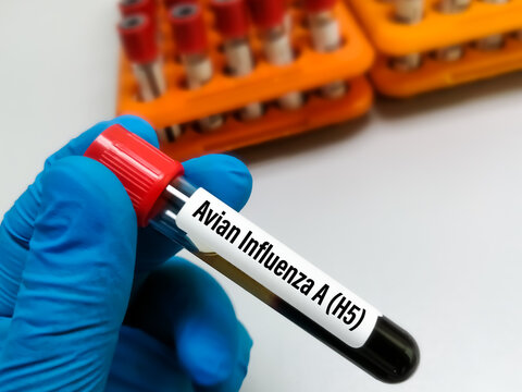 Blood sample for Avian Influenza A (H5) test.
