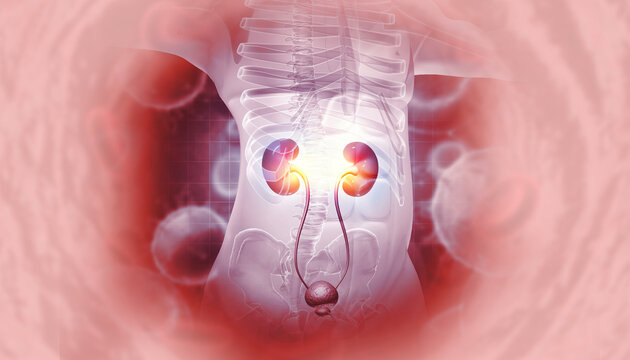Human kidney medical diagram, anatomy of the kidney, diseased kidney. 3d illustration