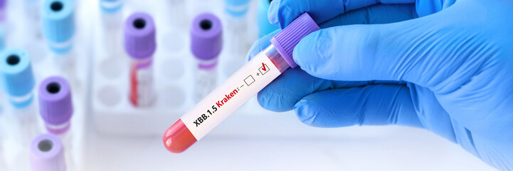 Doctor holding a test blood sample tube positive with Covid-19 XBB.1.5 Kraken Variant test. Banner