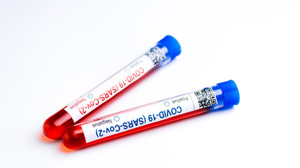 flasks with blood tests for monkey pox virus positive and negative, mpox