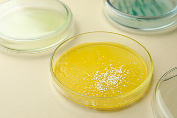 Petri dishes with different bacteria colonies on beige background, closeup