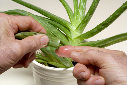 Putting Aloe Vera on a minor burn.
