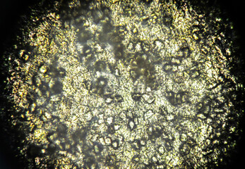 An orange seed peel under light microscope