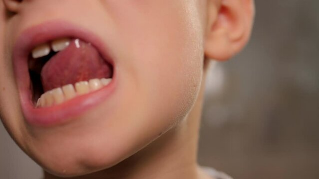 Close-up of a little boy's face with his mouth open, he shows his changing teeth.