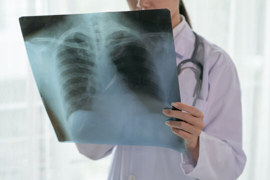 Female radiology doctor examining at x ray film of patient at hospital room, lung radiography concept