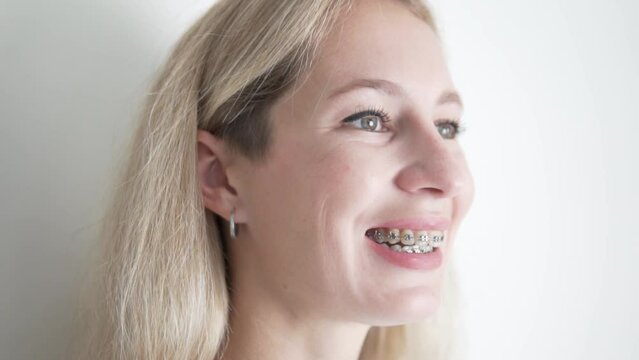 A beautiful young woman with braces on her teeth smiles