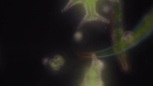 Algae and Protist in waste water under the microscope.