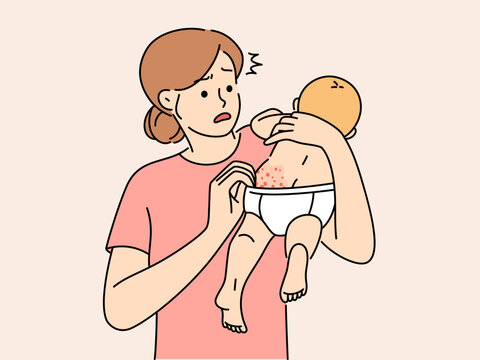 recommend clip art: Anxious young mother confused with baby body rash
