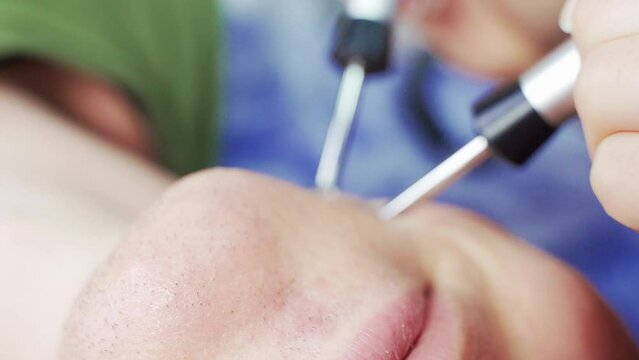 close-up microcurrent procedure treatment of chin lines microcurrent procedure in a beauty salon, facial treatments