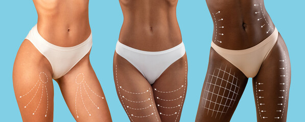 Millennial mixed race, european, black ladies in bikini with slim body with lines for figure shaping