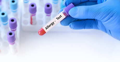 Doctor holding a test blood sample tube positive with allergy test on the background of medical test tubes with analyzes.Copy space for text - obrazy, fototapety, plakaty
