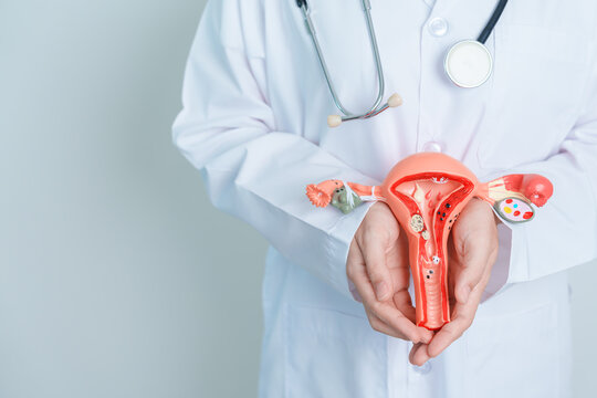 Doctor holding Uterus and Ovaries model. Ovarian and Cervical cancer, Cervix disorder, Endometriosis, Hysterectomy, Uterine fibroids, Reproductive system and Pregnancy concept