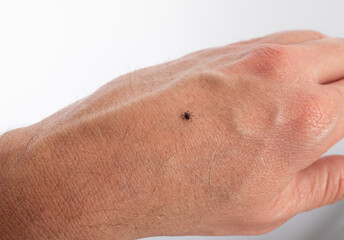 Fototapeta premium Zecke auf der Hand