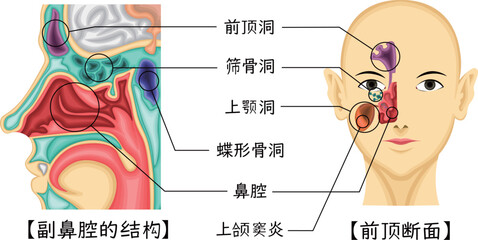 副鼻腔　構造　イラスト