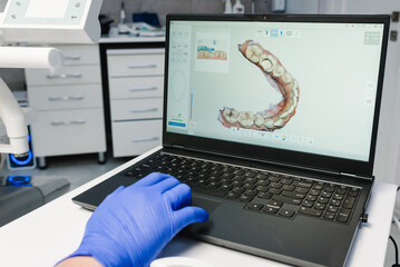 Dental intraoral 3d scanner with teeth on display and laptop in dentist office. Dentistry and...