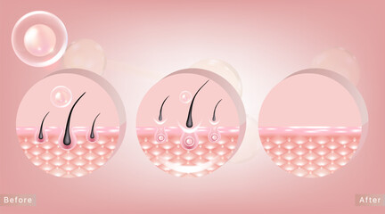Hyaluronic acid before and after hair and skin solutions ad, pink removing serum drop over skin cells with cosmetic advertising background ready to use, illustration vector.