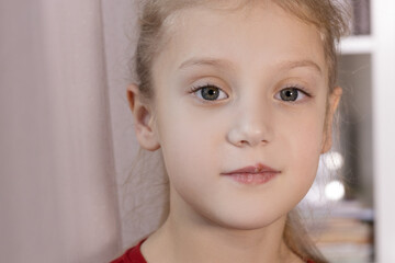 Children's herpes virus on the lip of a sick girl. The child points a finger at the wound on the upper lip. Close-up of the disease