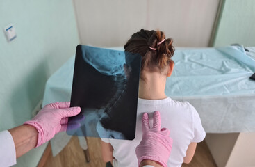 Pediatrician doctor examines x-ray of child spinal deformity - obrazy, fototapety, plakaty