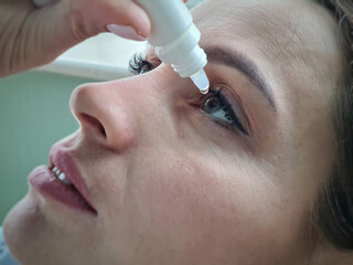 Woman dripping into her eyes with antibacterial drops closeup