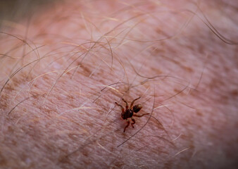 Eine V-Fleck Springspinne auf der Haut einen Menschen.