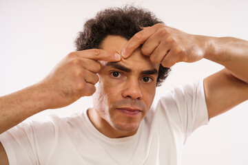 Mixed race man is squeezing pimple on his forehead.