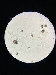 Notoedres cati under the microscope. Notoedric mange, also referred to as Feline scabies.