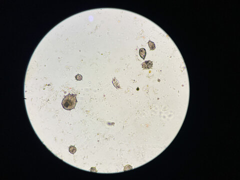 Notoedres cati under the microscope. Notoedric mange, also referred to as Feline scabies.
