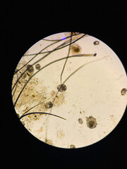 Notoedres cati under the microscope. Notoedric mange, also referred to as Feline scabies
