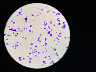 View in microscopic of dog vaginal smear cells.Squamous epithelium cells.Superficial and...
