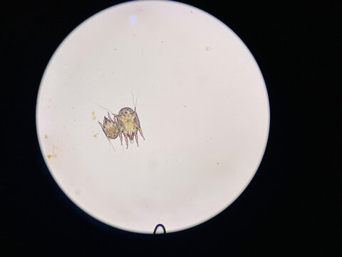 Otodectes cynotis, or ear mites under the microscope. This mites are found in cat's ear. it can causing otitis externa.