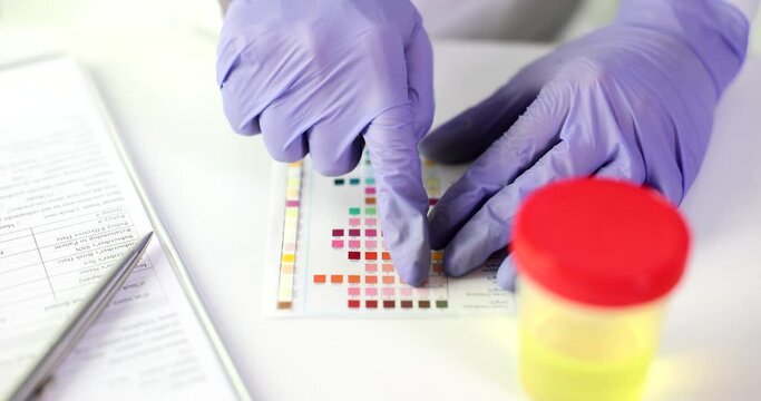 Urologist doctor makes express analysis of urine using indicator paper closeup