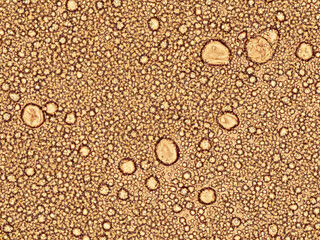 breast milk under the microscope - optical microscope x400 magnification