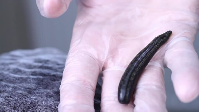 A medical leech full of blood lies on the palm of hand, wearing a glove