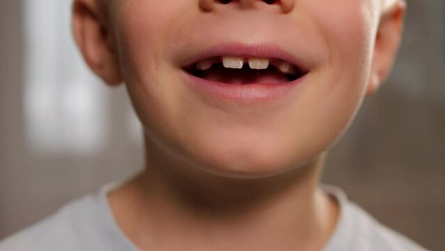 Close-up of the baby's milk and new molars. The boy smiles and shows his fallen baby teeth.