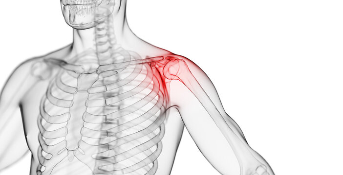 3d rendered medical illustration of a man with shoulder pain