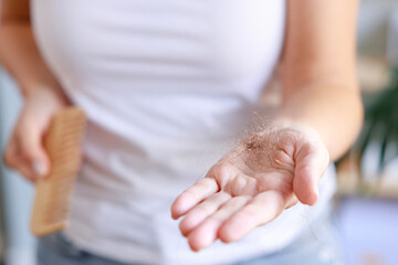 Woman hand holding hair fall from the comb or hairbrush