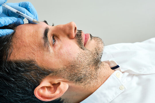 45-year-old dark-haired man in an aesthetic clinic being treated with botulinum toxin