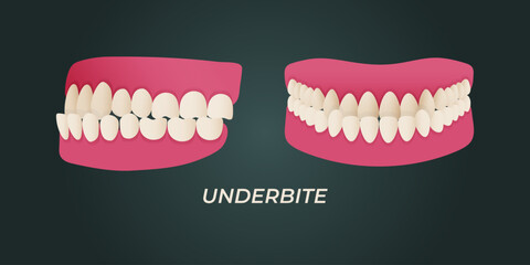 Medical dental diagram illustration. Orthodontist human tooth anatomy. Vector infographics with teeth diagrams.