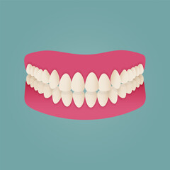 Human teeth malocclusion set with realistic images of mouth jaws with crooked teeth and text captions. Normal and abnormal occlusion. Vector illustration