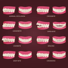 Medical dental diagram illustration. Orthodontist human tooth anatomy. Vector infographics with teeth diagrams.