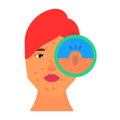 Acne Icon