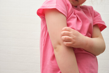 child scratches atopic skin. Dermatitis, diathesis, allergy on the child's body.irritation and pruritus.