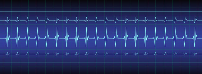 ecg, ekg monitor with cardio diagnosis illustration. Heart rhythm line vector design to use in healthcare, healthy lifestyle, medicine, ekg, ecg concept illustration projects.
