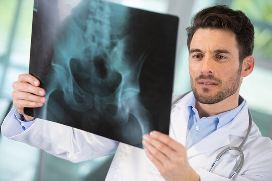 male radiologist looking at an x-ray