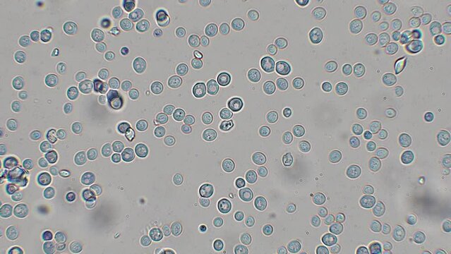 yeast cells under the microscope (bakery yeast) - optical microscope x1000 magnification