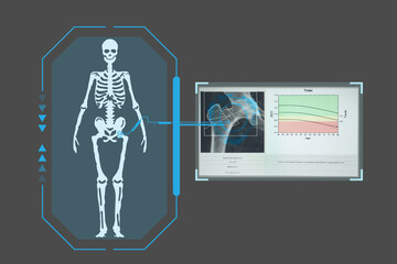 Examines a technological digital holographic plate representing the patient's body, results of densitometry , Concept: Futuristic medicine, Medical technology concept.