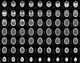 Horizontal sections of a complete human brain scan.