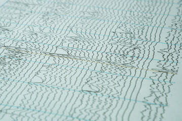 Background of electroencephalography or human brain waves