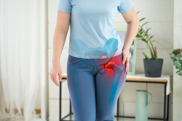 Hip joint pain, woman suffering from osteoarthritis at home - obrazy, fototapety, plakaty